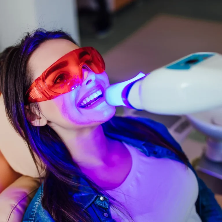 Teeth Whitening London Ontario