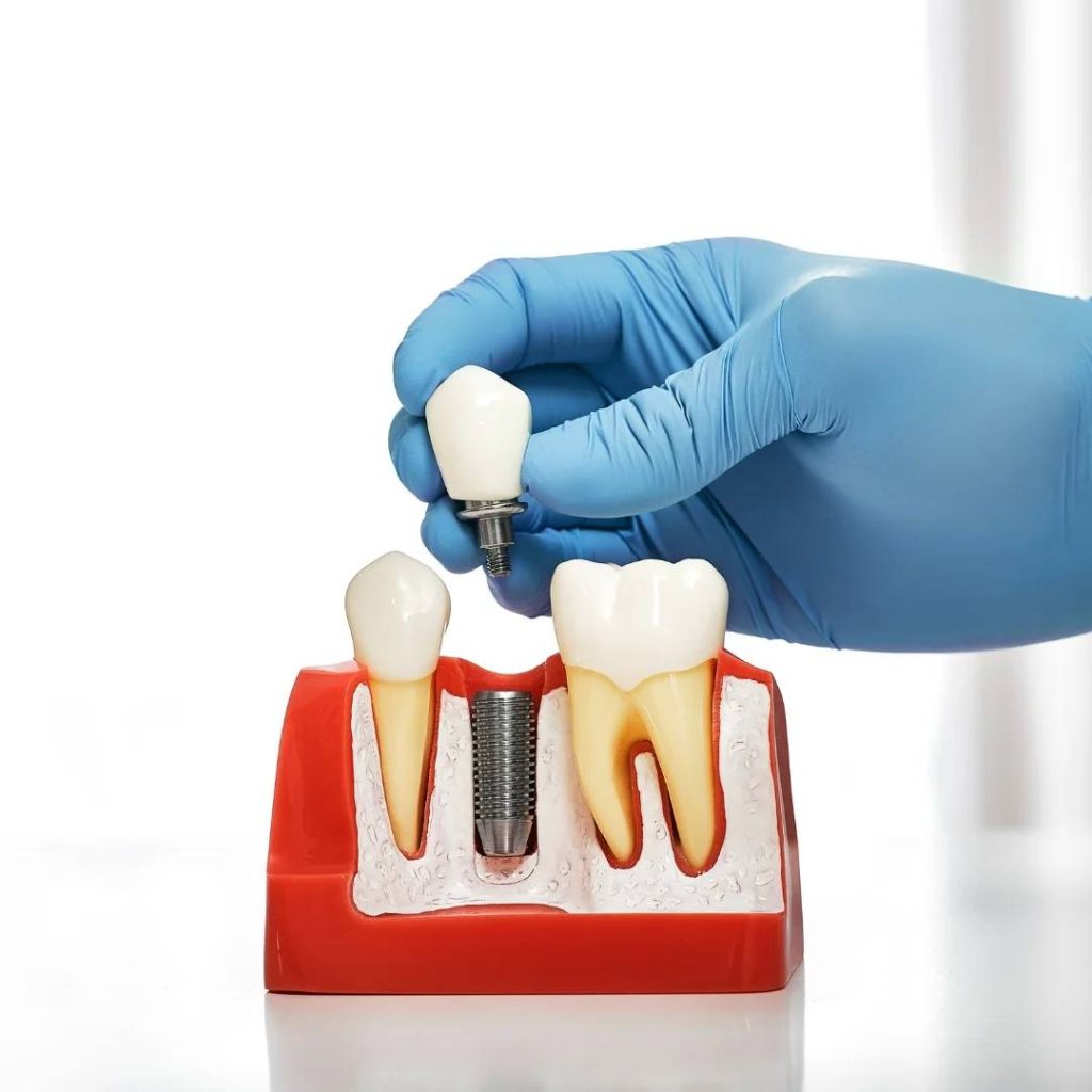 Restorative Dental Care in London, ON