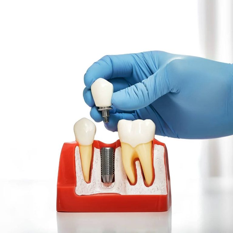 Restorative Dental Care in London, ON