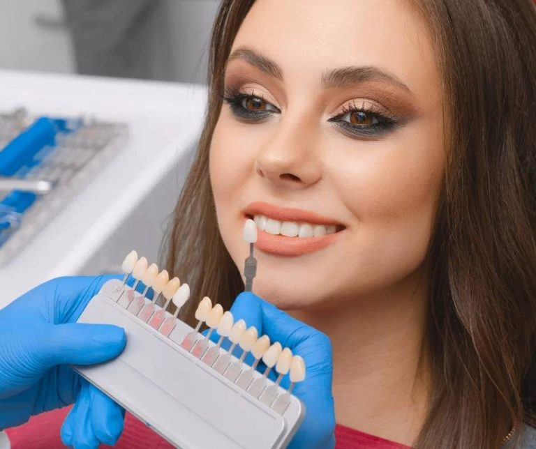 professional teeth whitening London Ontario