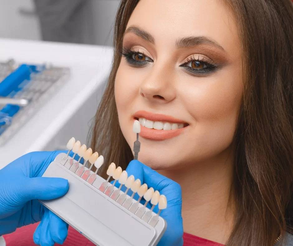 professional teeth whitening London Ontario